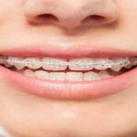 Orthodonic (1)
